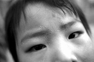 專業和非專業有啥區別？“三無”除甲醛公司致一家三口灼傷眼睛