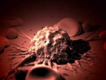 癌癥、白血病越來越多,是因?yàn)闀r(shí)代在進(jìn)步而導(dǎo)致的嗎?